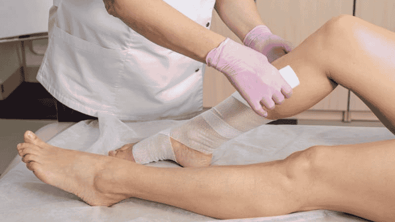 Paciente com lipedema recebendo fisioterapia adequada como parte do tratamento não cirúrgico.
