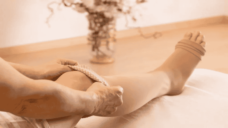 Mulher usando meias de compressão como parte do tratamento do lipedema